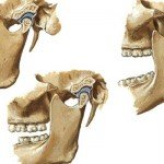 Vista lateral de articulação temporomandibular em diferentes posições da mandíbula