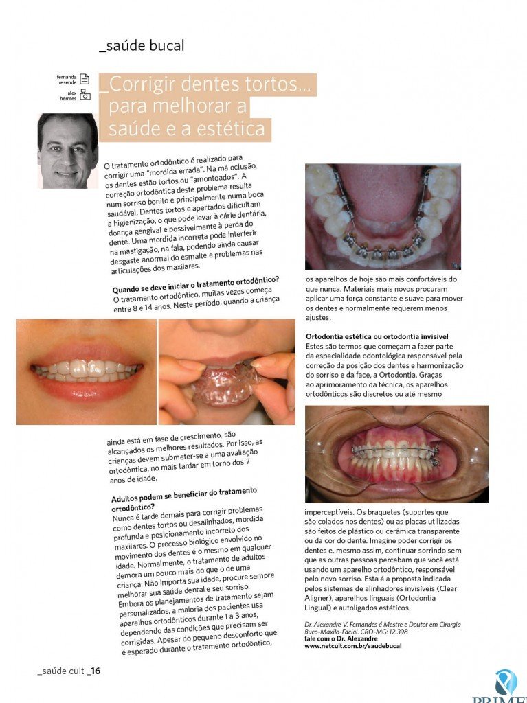 Cult 75 – Corrigir dentes tortos para melhorar a saúde e a estética
